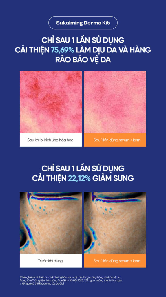 Sukalming Derma Kit 5